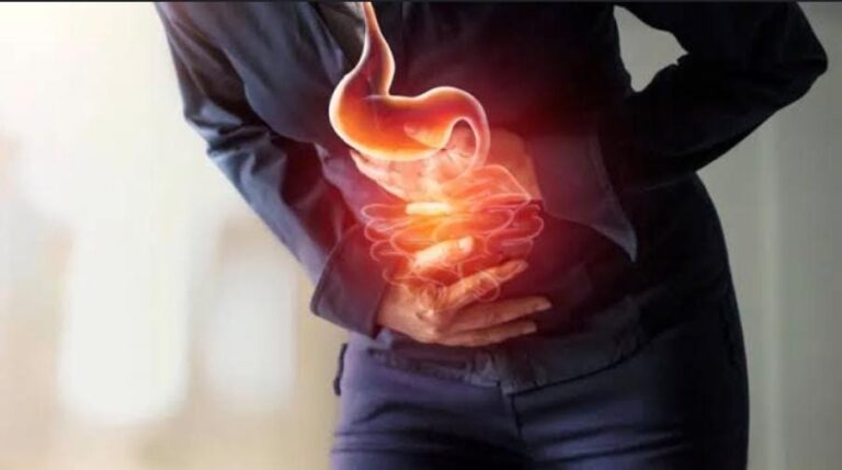 Acid Belching, Loose Motions, Eczema? Check Your Fermented Intake!!!